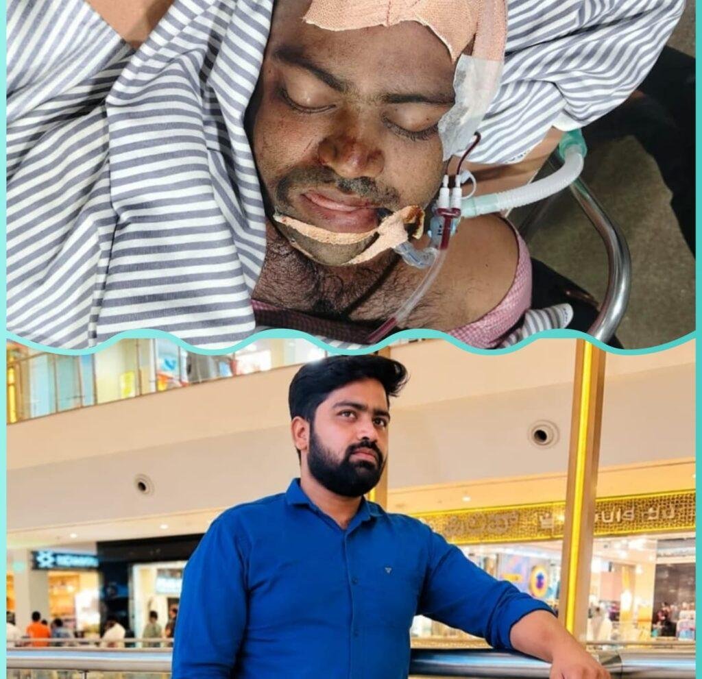 రోడ్డు ప్రమాదంలో గాయపడిన కవ్వంపల్లి గంగాధర్ చికిత్స పొందుతూ మృతి