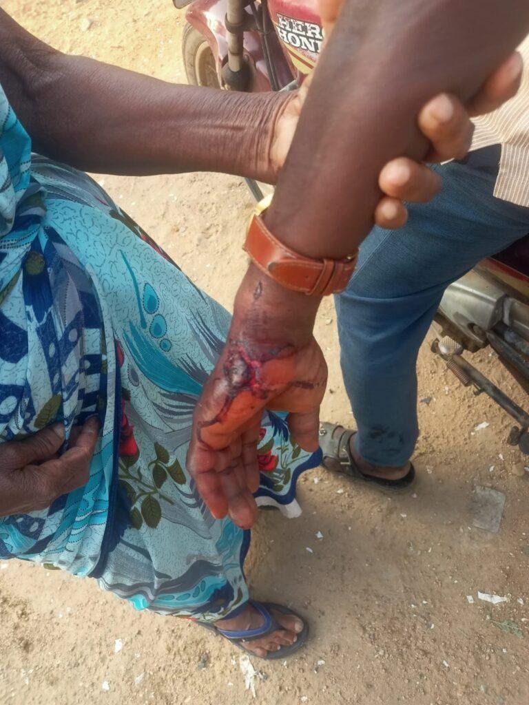 ఈస్ట్‌ హరిజనవాడలో పిచ్చికుక్క హల్‌చల్‌
